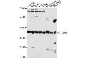Western blot analysis of extracts of various cell lines, using OTUD6B antibody (ABIN6293808) at 1:3000 dilution. (OTUD6B Antikörper)