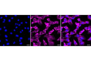 anti-Cadherin 4 (CDH4) antibody