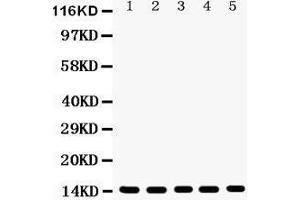 Anti- Profilin1 Picoband antibody, Western blotting All lanes: Anti Profilin1  at 0. (PFN1 Antikörper  (C-Term))