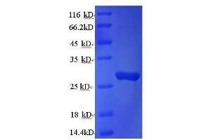 SDS-PAGE (SDS) image for Cathepsin K (CTSK) (AA 115-329) protein (His tag) (ABIN7584030)
