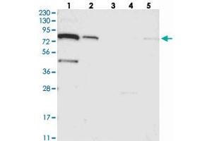 Western blot analysis of Lane 1: RT-4, Lane 2: U-251 MG, Lane 3: Human Plasma, Lane 4: Liver, Lane 5: Tonsil with SLC6A12 polyclonal antibody .
