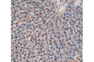 IHC-P analysis of liver tissue, with DAB staining.