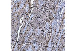 IHC analysis of TRMT6 using anti-TRMT6 antibody (ABIN7602138).