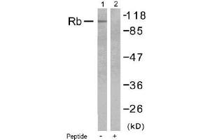 Image no. 1 for anti-Retinoblastoma 1 (RB1) (Ser795) antibody (ABIN197280) (Retinoblastoma 1 Antikörper  (Ser795))