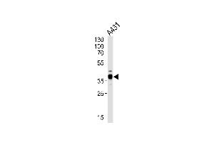 Western blot analysis of lysate from A431 cell line, using ARPC1B Antibody (Center) (ABIN652700 and ABIN2842466).