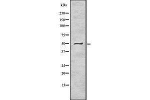 Western blot analysis of PNLIP using Jurkat whole cell lysates (PNLIP Antikörper  (C-Term))