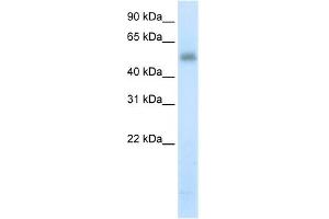 WB Suggested Anti-METTL3 Antibody Titration:  5. (METTL3 Antikörper  (N-Term))