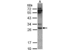 WB Image Sample(30 ug whole cell lysate) A:Hep G2 , 7. (PSMA6 Antikörper  (Center))
