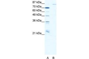Western Blotting (WB) image for anti-Mediterranean Fever (MEFV) antibody (ABIN2460356) (MEFV Antikörper)