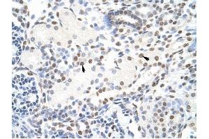 NONO antibody was used for immunohistochemistry at a concentration of 4-8 ug/ml to stain Epithelial cells of renal tubule (arrows) in Human Kidney.