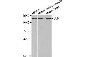 Western blot analysis of extracts of various cell lines, using LUM antibody (ABIN5973088) at 1/1000 dilution. (LTBR Antikörper)