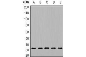 Western blot analysis of DGUOK expression in HepG2 (A), mouse heart (B), mouse kidney (C), rat liver (D), rat brain (E) whole cell lysates. (Deoxyguanosine Kinase Antikörper)