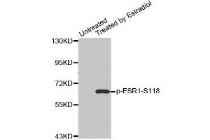 Western blot analysis of extracts from MDA cells using Phospho-ESR1-S118 antibody (ABIN2987431). (Estrogen Receptor alpha Antikörper  (pSer118))