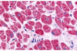 Immunohistochemistry (IHC) image for anti-Endothelin Receptor Type A (EDNRA) (Extracellular Domain) antibody (ABIN1048556)