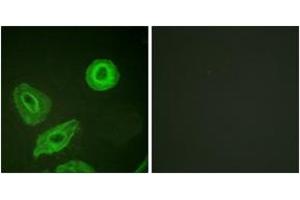 Immunofluorescence analysis of HeLa cells, using HER3 (Phospho-Tyr1289) Antibody.