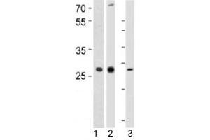 Western Blotting (WB) image for anti-Leukemia Inhibitory Factor (LIF) (AA 72-101) antibody (ABIN3031614)