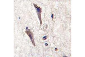 Image no. 1 for anti-Sprouty-Related, EVH1 Domain Containing 1 (SPRED1) (N-Term) antibody (ABIN356947) (SPRED1 Antikörper  (N-Term))