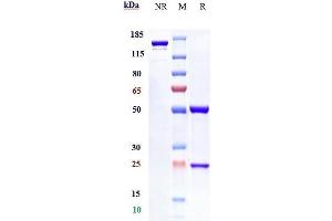 Anti-IFNAR1 Reference Antibody (anifrolumab) on SDS-PAGE under reducing (R) condition. (Rekombinanter IFNAR1 (Anifrolumab Biosimilar) Antikörper)