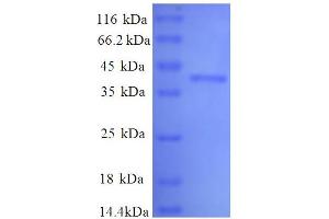 SDS-PAGE (SDS) image for Lactate Dehydrogenase A (LDHA) (AA 5-323), (partial) protein (His tag) (ABIN1095667)