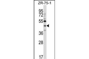 NEUROD6 Antibody (N-term ) (ABIN657404 and ABIN2846444) western blot analysis in ZR-75-1 cell line lysates (35 μg/lane). (NEUROD6 Antikörper  (N-Term))