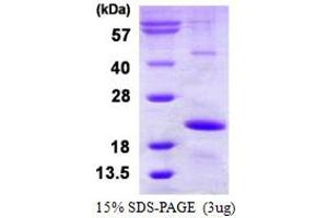 Heat Shock Protein, alpha-Crystallin-Related, B9 (HSPB9) (AA 1-159) protein (His tag)