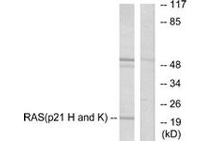 Western blot analysis of extracts from HeLa cells, using RASH/RASK Antibody. (RASH/RASK (AA 1-50) Antikörper)