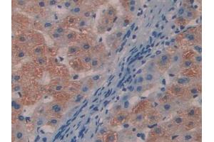 DAB staining on IHC-P; Samples: Human Liver Tissue (MYL9 Antikörper  (AA 5-163))