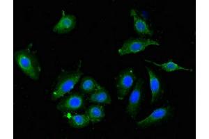 Immunofluorescent analysis of A549 cells using ABIN7149934 at dilution of 1:100 and Alexa Fluor 488-congugated AffiniPure Goat Anti-Rabbit IgG(H+L) (DPYSL4 Antikörper  (AA 280-560))
