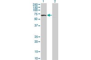 Western Blot analysis of KLHDC4 expression in transfected 293T cell line by KLHDC4 monoclonal antibody (M02), clone 4G11. (KLHDC4 Antikörper  (AA 1-463))