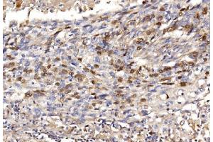 IHC analysis of Geminin/GMNN using anti-Geminin/GMNN antibody (ABIN7600598). (Geminin Antikörper  (AA 21-196))