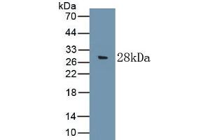 Detection of Recombinant C9, Rat using Polyclonal Antibody to Complement Component 9 (C9) (C9 Antikörper  (AA 336-554))