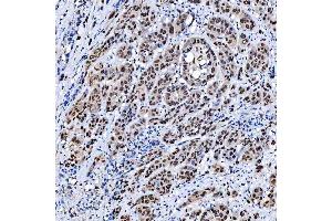IHC analysis of SCML1 using anti-SCML1 antibody (ABIN7602479).