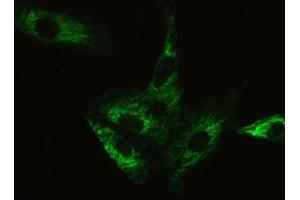 IF/ICC testing of human A549 cells with Ataxin-2 antibody at 2ug/ml. (Ataxin 2 Antikörper  (C-Term))