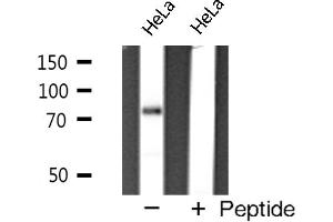 Western blot analysis of FOXP2 expression in HeLa cells (FOXP2 Antikörper)