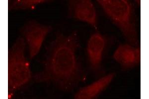 Immunofluorescence staining of methanol-fixed Hela cells using Merlin(Phospho-Ser518) Antibody. (Merlin Antikörper  (pSer518))