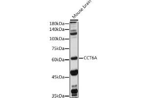Western blot analysis of extracts of Mouse brain, using CCT6A antibody (ABIN1679063, ABIN3017847, ABIN3017849 and ABIN6220290) at 1:1000 dilution. (CCT6A Antikörper  (AA 80-250))