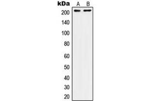 Western blot analysis of CD104 expression in A431 (A), SW480 (B) whole cell lysates.