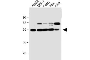 All lanes : Anti-CLU Antibody (N-term) at 1:1000 dilution Lane 1: HepG2 whole cell lysate Lane 2: MCF-7 whole cell lysate Lane 3: Caco2 whole cell lysate Lane 4: Hela whole cell lysate Lane 5: A549 whole cell lysate Lysates/proteins at 20 μg per lane. (Clusterin Antikörper  (N-Term))