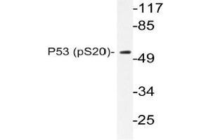 Western blot (WB) analysis of p-P53 antibody in extracts from COS7 cells. (p53 Antikörper  (pSer20))