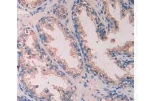 Used in DAB staining on fromalin fixed paraffin- embedded Kidney tissue (SCUBE3 Antikörper  (AA 807-993))