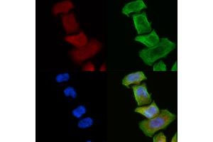 ABIN6258297 and ABIN6275828 staining Hela cells(30 min of UV treatment) by IF/ICC.