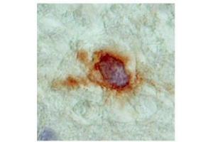 SLC18A2 (VMAT2) in the cortex of human brain was detected using SLC18A2 antibody at a dilution of 5-10 ug/ml and stained with HRP/DAB brown color stain. (SLC18A2 Antikörper)