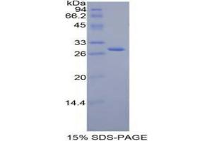 SDS-PAGE analysis of Mouse Jagged 2 Protein. (JAG2 Protein)