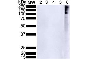 Western Blot analysis of Human Alpha Synuclein showing detection of Alpha Synuclein pSer129 protein using Rabbit Anti-Alpha Synuclein pSer129 Monoclonal Antibody, Clone J18 (ABIN6932861).