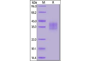 Cynomolgus FOLR2, His Tag on  under reducing (R) condition. (FOLR2 Protein (AA 34-245) (His tag))