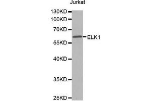Western blot analysis of extracts of Jurkat cells tissue, using ELK1 antibody. (ELK1 Antikörper  (AA 90-250))