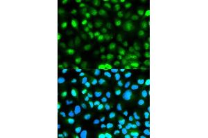 Immunofluorescence analysis of HeLa cells using ATXN3 antibody. (Ataxin 3 Antikörper  (AA 1-364))