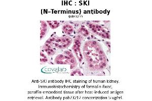 Image no. 2 for anti-SKI Proto-Oncogene (SKI) antibody (ABIN1739312) (SKI Antikörper)