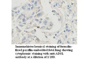 Image no. 1 for anti-Adenylosuccinate Lyase (ADSL) antibody (ABIN1574515) (Adenylosuccinate Lyase Antikörper)