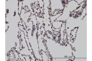 Immunoperoxidase of monoclonal antibody to DLX2 on formalin-fixed paraffin-embedded human lung. (DLX2 Antikörper  (AA 1-110))